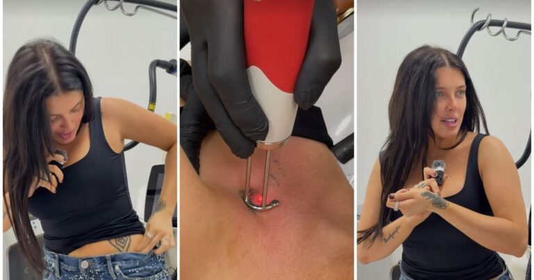 Sofía Gonet durante una sesión de láser para remover tatuajes